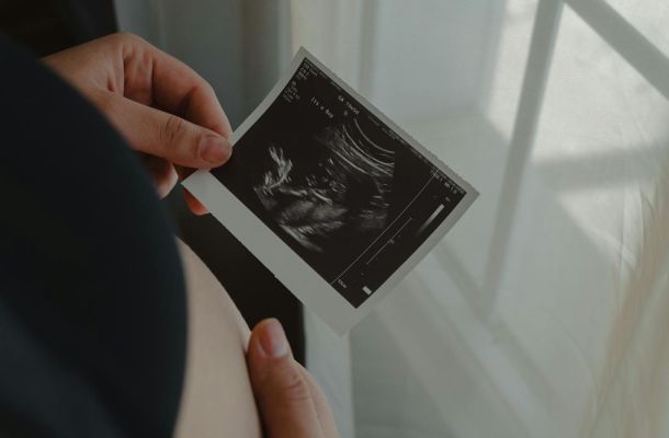 person holding an ultrasound scan photo
